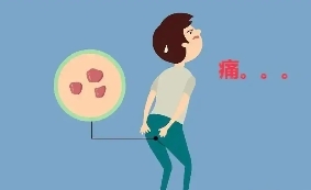 宁夏康源肛肠医院：肛门坠胀有便意却排不出是怎么回事？