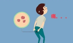 宁夏康源肛肠医院：肛门瘙痒为什么不可以挠？