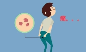 宁夏康源肛肠医院：肛门疼痛一般伴随哪些症状？