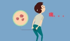 宁夏康源肛肠医院：如何应对肛门下坠感？